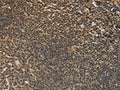 The image on the left is immunohistochemistry of paraffin-embedded Human tonsil tissue using CSB-PA903639(DACH1 Antibody) at dilution 1/50, on the right is treated with fusion protein. (Original magnification: ×200)