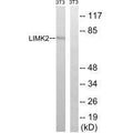 Western blot analysis of extracts from 3T3 cells, treated with PMA (125ng/ml, 30mins), using LIMK2 (Ab-283) antibody.