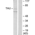 Western blot analysis of extracts from HeLa cells, using Tau (Ab-396) antibody.