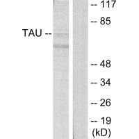 Western blot analysis of extracts from HeLa cells, using Tau (Ab-396) antibody.