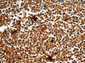 The image on the left is immunohistochemistry of paraffin-embedded Human tonsil tissue using CSB-PA904228(MYOZ1 Antibody) at dilution 1/50, on the right is treated with fusion protein. (Original magnification: ×200)