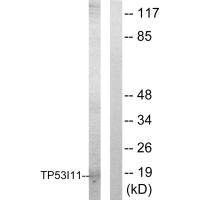 Western blot analysis of extracts from HUVEC cells, using TP53I11 antibody.
