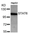 Western blot analysis of extracts from HepG2 cells using STAT6(Ab-641) Antibody.
