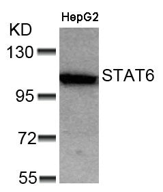 Western blot analysis of extracts from HepG2 cells using STAT6(Ab-641) Antibody.
