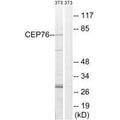 Western blot analysis of extracts from 3T3 cells, using CEP76 antibody.
