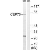 Western blot analysis of extracts from 3T3 cells, using CEP76 antibody.