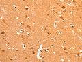 The image on the left is immunohistochemistry of paraffin-embedded Human brain tissue using CSB-PA904462(GRM3 Antibody) at dilution 1/50, on the right is treated with fusion protein. (Original magnification: ×200)