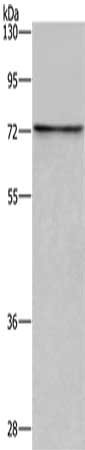 Gel: 8%SDS-PAGE, Lysate: 40 ug, Lane: Raji cells, Primary antibody: CSB-PA904467(ACHE Antibody) at dilution 1/600, Secondary antibody: Goat anti rabbit IgG at 1/8000 dilution, Exposure time: 5 minutes