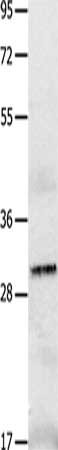 Gel: 10+12%SDS-PAGE, Lysate: 40 ug, Lane: A549 cells, Primary antibody: CSB-PA904921(IL2RA Antibody) at dilution 1/750, Secondary antibody: Goat anti rabbit IgG at 1/8000 dilution, Exposure time: 1 second