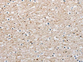 The image on the left is immunohistochemistry of paraffin-embedded Human brain tissue using CSB-PA905307(ARHGAP1 Antibody) at dilution 1/25, on the right is treated with fusion protein. (Original magnification: ×200)
