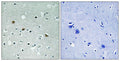 Immunohistochemical analysis of paraffin-embedded human brain tissue using LATS1/2 (Phospho-Thr1079/1041) antibody (left)or the same antibody preincubated with blocking peptide (right).