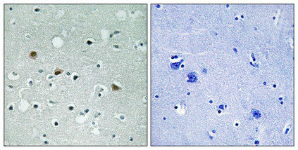 Immunohistochemical analysis of paraffin-embedded human brain tissue using LATS1/2 (Phospho-Thr1079/1041) antibody (left)or the same antibody preincubated with blocking peptide (right).