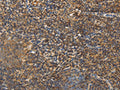 The image on the left is immunohistochemistry of paraffin-embedded Human tonsil tissue using CSB-PA905587(PCP4 Antibody) at dilution 1/20, on the right is treated with fusion protein. (Original magnification: ×200)