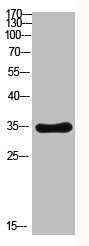 Western Blot analysis of MOUSE-BRIAN cells using Antibody diluted at 2000. Secondary antibody  was diluted at 1:20000