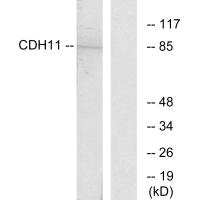 Western blot analysis of extracts from Jurkat cells, using CDH11 antibody.