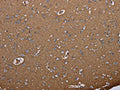 The image on the left is immunohistochemistry of paraffin-embedded Human brain tissue using CSB-PA905782(AQP4 Antibody) at dilution 1/20, on the right is treated with synthetic peptide. (Original magnification: ×200)