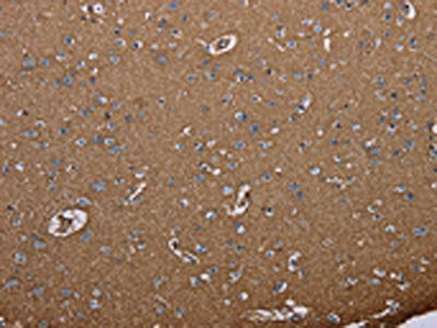 The image on the left is immunohistochemistry of paraffin-embedded Human brain tissue using CSB-PA905782(AQP4 Antibody) at dilution 1/20, on the right is treated with synthetic peptide. (Original magnification: ×200)