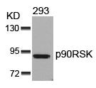 Western blot analysis of extracts from 293 cells using p90RSK(Ab-352) Antibody.