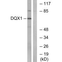 Western blot analysis of extracts from COS-7 cells, using DQX1 antibody.
