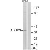 Western blot analysis of extracts from MCF-7 cells, using ABHD9 antibody.