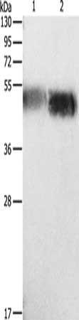 Gel: 12%SDS-PAGE, Lysate: 40 ug, Lane 1-2: Human testis tissue, Human prostate tissue, Primary antibody: CSB-PA906899(ORM1 Antibody) at dilution 1/133, Secondary antibody: Goat anti rabbit IgG at 1/8000 dilution, Exposure time: 2 minutes