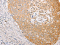 MARK1 Antibody – Figure 1 of 3