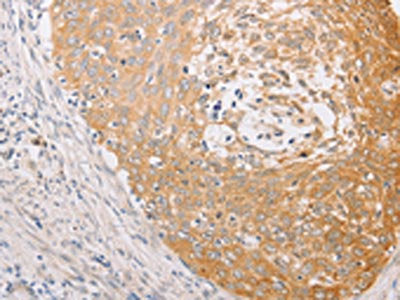 MARK1 Antibody – Figure 1 of 3