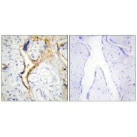 Immunohistochemistry analysis of paraffin-embedded human placenta tissue using CKI-ε antibody.