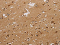 The image on the left is immunohistochemistry of paraffin-embedded Human brain tissue using CSB-PA907913(CASP10 Antibody) at dilution 1/20, on the right is treated with synthetic peptide. (Original magnification: ×200)