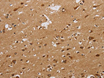 The image on the left is immunohistochemistry of paraffin-embedded Human brain tissue using CSB-PA907913(CASP10 Antibody) at dilution 1/20, on the right is treated with synthetic peptide. (Original magnification: ×200)