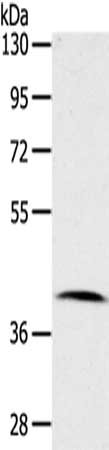 Gel: 8%SDS-PAGE,Lysate: 40 ug,,Primary antibody: CSB-PA908142(CDK10 Antibody) at dilution 1/100 dilution,Secondary antibody: Goat anti rabbit IgG at 1/8000 dilution,Exposure time: 20 seconds