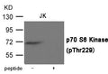 Western blot analysis of extracts from JK cells using p70 S6 Kinase (Phospho-Thr229) Antibody.The lane on the right is treated with the antigen-specific peptide.