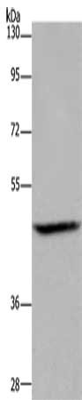 Gel: 8%SDS-PAGE, Lysate: 40 ug, Lane: Mouse brain tissue, Primary antibody: CSB-PA908387(ETS2 Antibody) at dilution 1/500, Secondary antibody: Goat anti rabbit IgG at 1/8000 dilution, Exposure time: 1 minute
