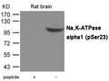 Western blot analysis of extracts from Rat brain tissue using Na,K-ATPase alpha1(Phospho-Ser23) Antibody.The lane on the left is treated with the antigen-specific peptide.