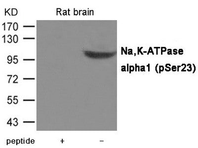 Western blot analysis of extracts from Rat brain tissue using Na,K-ATPase alpha1(Phospho-Ser23) Antibody.The lane on the left is treated with the antigen-specific peptide.