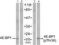 Western blot analysis of extracts from MDA-MB-435 cells, untreated or EGF-treated (200 ng/ml, 30min), using 4E-BP1 (Ab-36) antibody (Lane 1 and 2) and 4E-BP1 (phospho-Thr36) antibody (Lane 3 and 4).