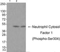 Western blot analysis of extracts from JK cells (Lane 2) and cos-7 cells (Lane 3), using Neutrophil Cytosol Factor 1 (Phospho-Ser304) Antibody. The lane on the left is treated with antigen-specific peptide.