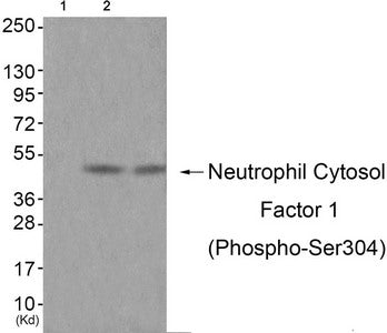 Western blot analysis of extracts from JK cells (Lane 2) and cos-7 cells (Lane 3), using Neutrophil Cytosol Factor 1 (Phospho-Ser304) Antibody. The lane on the left is treated with antigen-specific peptide.