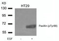 Western blot analysis of extracts from HT29 cells untreated or treated with EGF using Paxillin(phospho-Tyr88) Antibody.