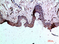 Immunohistochemical analysis of paraffin-embedded human-skin, antibody was diluted at 1:200