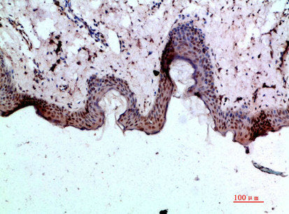 Immunohistochemical analysis of paraffin-embedded human-skin, antibody was diluted at 1:200