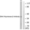 Western blot analysis of extracts from NIH/3T3 cells, using DNA Polymerase β antibody.