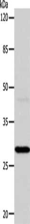 Gel: 10%SDS-PAGE, Lysate: 24 ug, Lane: Mouse liver tissue, Primary antibody: CSB-PA910869(CA1 Antibody) at dilution 1/450, Secondary antibody: Goat anti rabbit IgG at 1/8000 dilution, Exposure time: 2 minutes