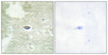 Immunohistochemical analysis of paraffin-embedded human brain tissue using TGF β Receptor II (Phospho-Ser225/250) antibody (left)or the same antibody preincubated with blocking peptide (right).