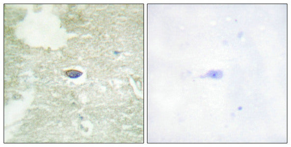 Immunohistochemical analysis of paraffin-embedded human brain tissue using TGF β Receptor II (Phospho-Ser225/250) antibody (left)or the same antibody preincubated with blocking peptide (right).
