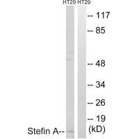 Western blot analysis of extracts from A549 cells, using Stefin A antibody.