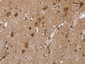 The image on the left is immunohistochemistry of paraffin-embedded Human brain tissue using CSB-PA911381(REL Antibody) at dilution 1/30, on the right is treated with fusion protein. (Original magnification: ×200)