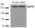Western blot analysis of extracts from HUVEC and MDA cells using EGFR(Ab-1197) Antibody.