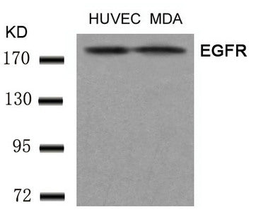 Western blot analysis of extracts from HUVEC and MDA cells using EGFR(Ab-1197) Antibody.