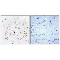 Immunohistochemistry analysis of paraffin-embedded human brain tissue, using HMG17 antibody.